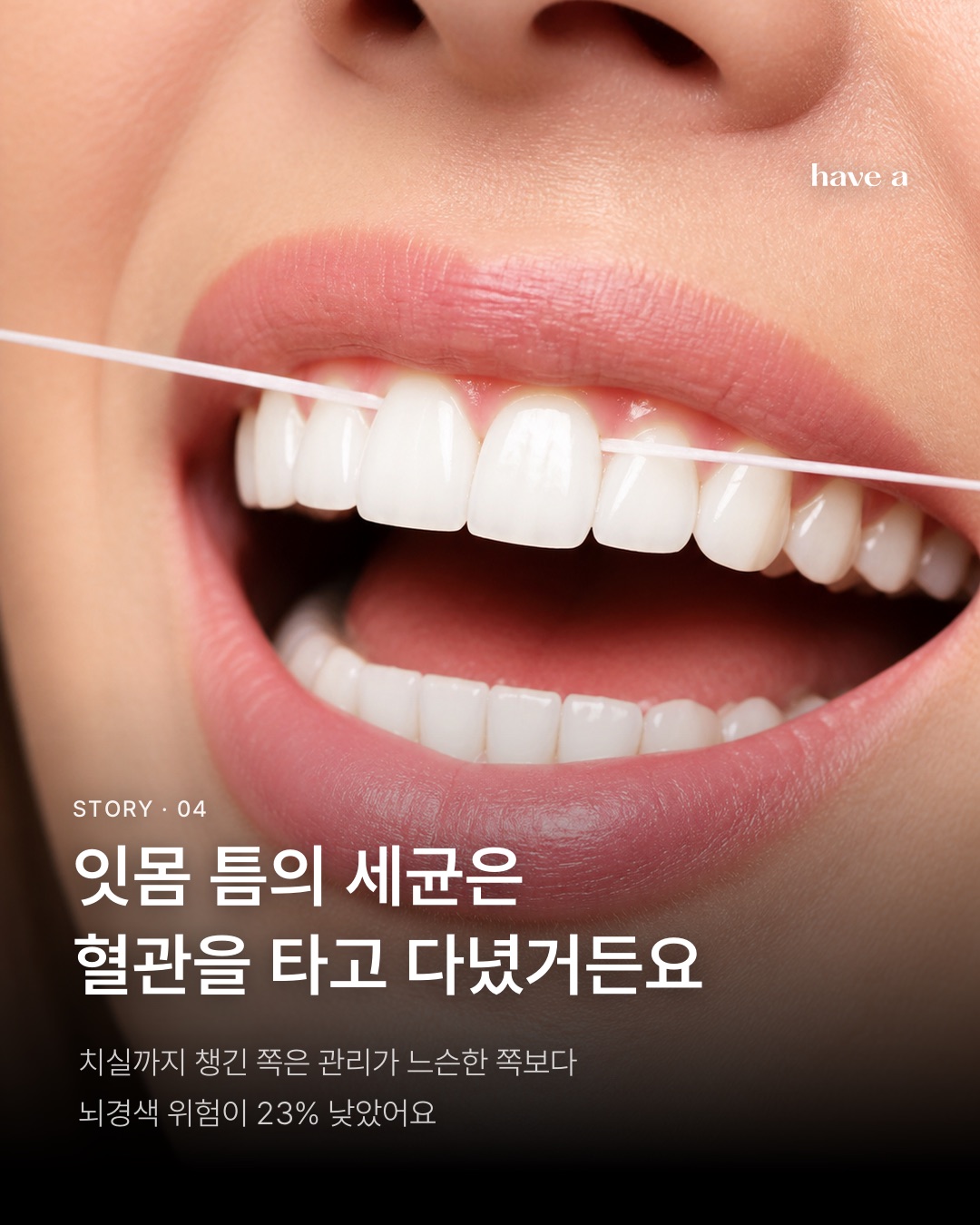 STORY 이미지 4