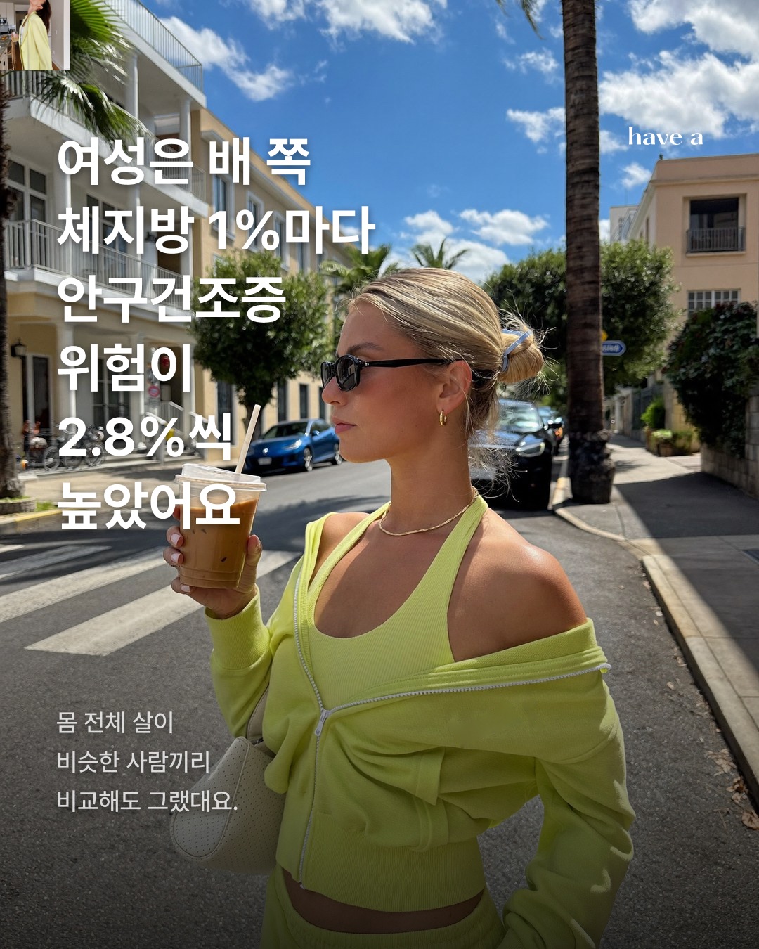 뻑뻑한 눈, 범인은 뱃살? 스토리 이미지